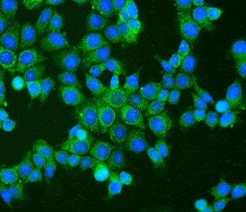 BAK/BAK1 Rabbit Polyclonal Antibody