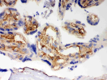 BAK/BAK1 Rabbit Polyclonal Antibody