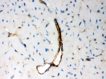 BAK/BAK1 Rabbit Polyclonal Antibody