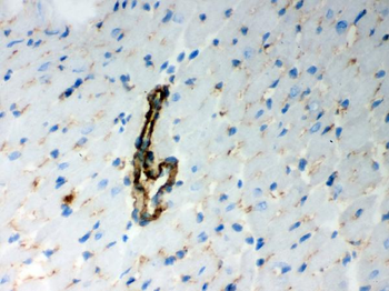 BAK/BAK1 Rabbit Polyclonal Antibody