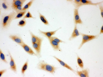 BAK/BAK1 Rabbit Polyclonal Antibody