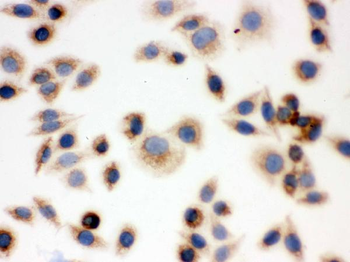 BAK/BAK1 Rabbit Polyclonal Antibody