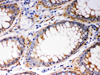 BAK/BAK1 Rabbit Polyclonal Antibody