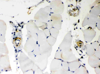 BAK/BAK1 Rabbit Polyclonal Antibody