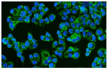 CD46 Rabbit Polyclonal Antibody