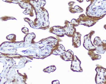 CD46 Rabbit Polyclonal Antibody