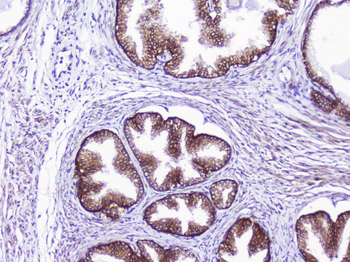 CD46 Rabbit Polyclonal Antibody