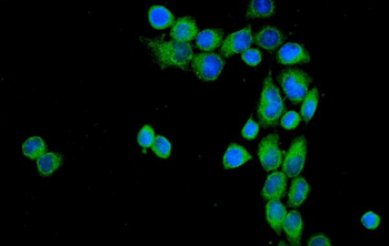 CD55 Rabbit Polyclonal Antibody
