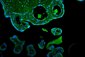 CD55 Rabbit Polyclonal Antibody