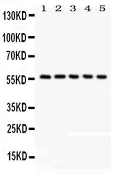 CREB3L1 Rabbit Polyclonal Antibody