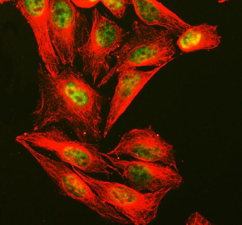 CTCF Rabbit Polyclonal Antibody
