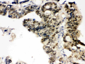 TCPTP/PTPN2 Rabbit Polyclonal Antibody