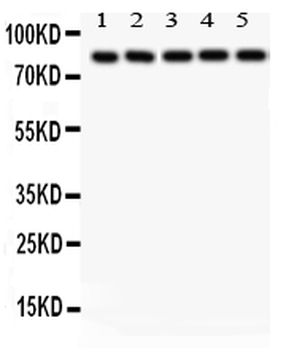 SOX5 Rabbit Polyclonal Antibody
