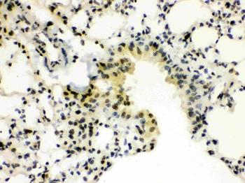 SP3 Rabbit Polyclonal Antibody