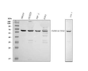 TNF Receptor II/TNFRSF1B Rabbit Polyclonal Antibody