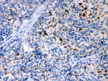 TNF Receptor II/TNFRSF1B Rabbit Polyclonal Antibody