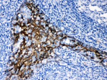 TRAF2 Rabbit Polyclonal Antibody