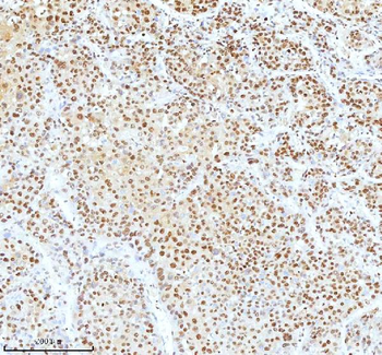 Ku70/XRCC6 Rabbit Polyclonal Antibody