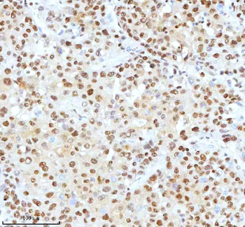 Ku70/XRCC6 Rabbit Polyclonal Antibody