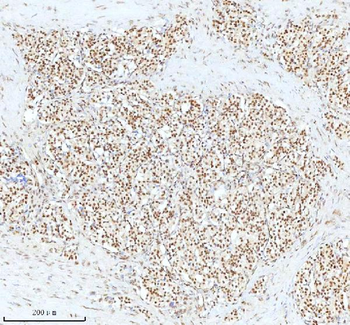 Ku70/XRCC6 Rabbit Polyclonal Antibody