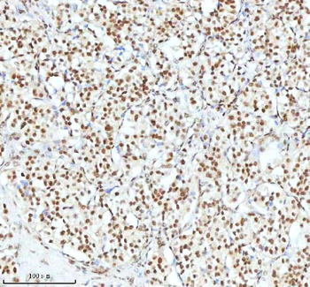 Ku70/XRCC6 Rabbit Polyclonal Antibody
