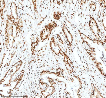 Ku70/XRCC6 Rabbit Polyclonal Antibody