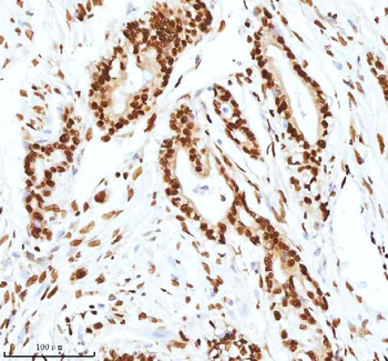 Ku70/XRCC6 Rabbit Polyclonal Antibody