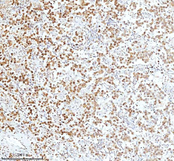 Ku70/XRCC6 Rabbit Polyclonal Antibody