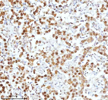 Ku70/XRCC6 Rabbit Polyclonal Antibody