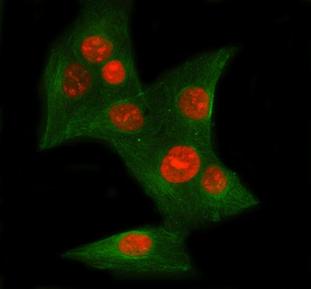 Ku70/XRCC6 Rabbit Polyclonal Antibody