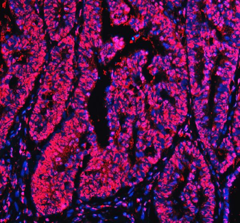Ku70/XRCC6 Rabbit Polyclonal Antibody