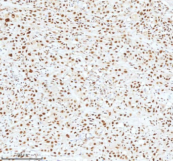 Ku70/XRCC6 Rabbit Polyclonal Antibody