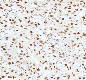 Ku70/XRCC6 Rabbit Polyclonal Antibody