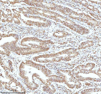 Ku70/XRCC6 Rabbit Polyclonal Antibody