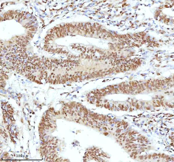 Ku70/XRCC6 Rabbit Polyclonal Antibody