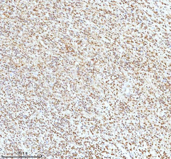 Ku70/XRCC6 Rabbit Polyclonal Antibody