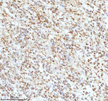 Ku70/XRCC6 Rabbit Polyclonal Antibody