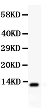 Estrogen Inducible Protein pS2/TFF1 Rabbit Polyclonal Antibody
