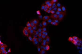 BAG2 Rabbit Polyclonal Antibody
