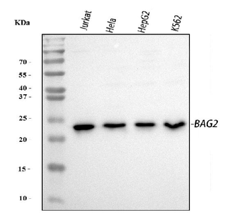 BAG2 Rabbit Polyclonal Antibody