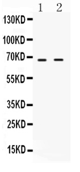 cIAP2/BIRC3 Rabbit Polyclonal Antibody