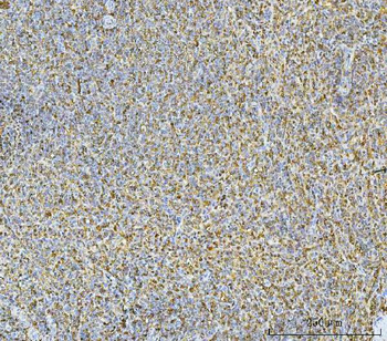 Carbonic Anhydrase I/CA1 Rabbit Polyclonal Antibody