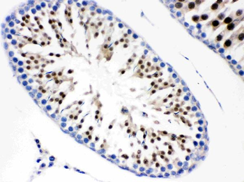 Cdc6 Rabbit Polyclonal Antibody