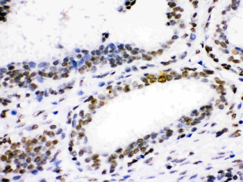 CDK1 Rabbit Polyclonal Antibody