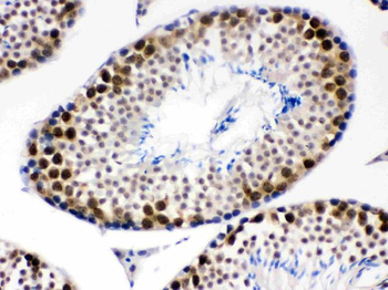 CDK1 Rabbit Polyclonal Antibody