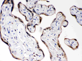 COMT Rabbit Polyclonal Antibody