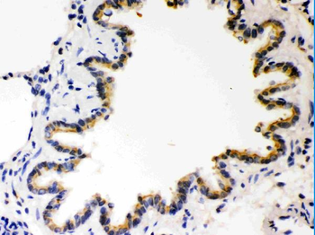 COMT Rabbit Polyclonal Antibody