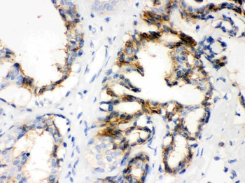 CTGF Rabbit Polyclonal Antibody