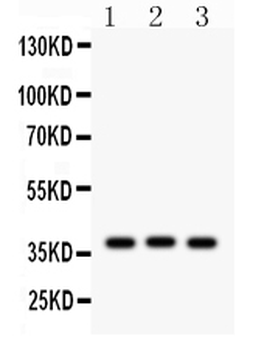 CTGF Rabbit Polyclonal Antibody