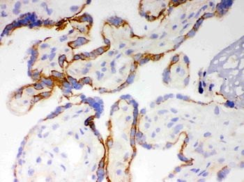 Cytochrome P450 1A1/CYP1A1 Rabbit Polyclonal Antibody
